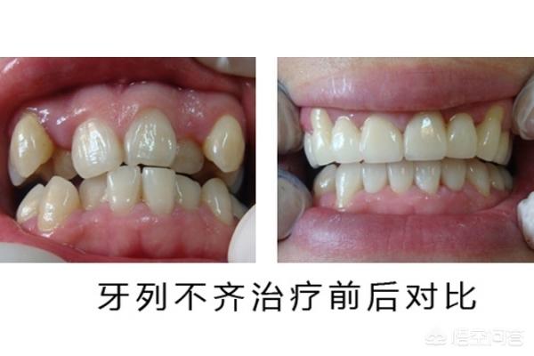 开平最新24小时牙医在线咨询方法分析(最方便真实的开平有没有24小时牙医方法)